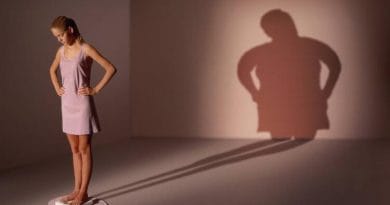 Yeme Bozuklukları Dsm 5 Tanı Kriterleri ANOREKSİYA NERVOZA